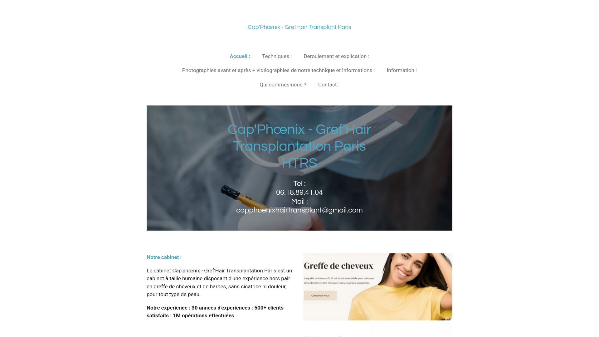 Cap'Phœnix-Gref'Hair TransplantGreffe de Cheveux Paris - Capillaire, Barbe, Afro | Cap'Phœnix-Gref'Hair Transplant