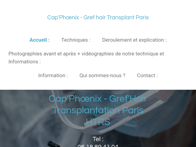 Greffe Cheveux Paris - Barbe, Afro | Cap'Ph&oelig;nix Hair Transplant